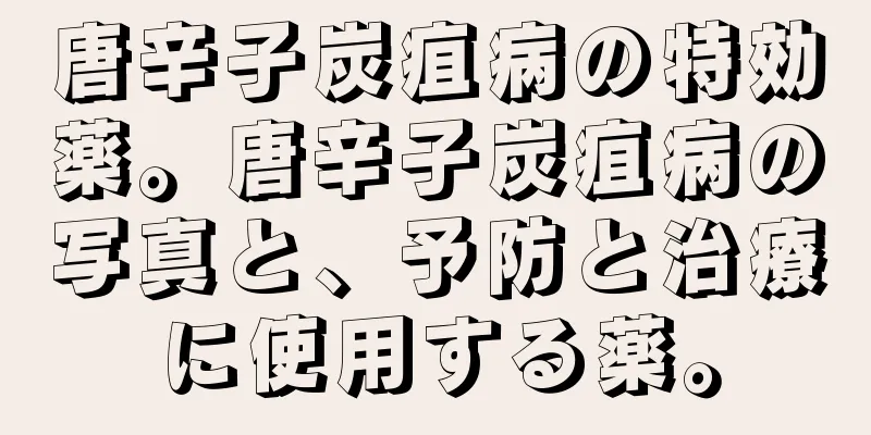 唐辛子炭疽病の特効薬。唐辛子炭疽病の写真と、予防と治療に使用する薬。